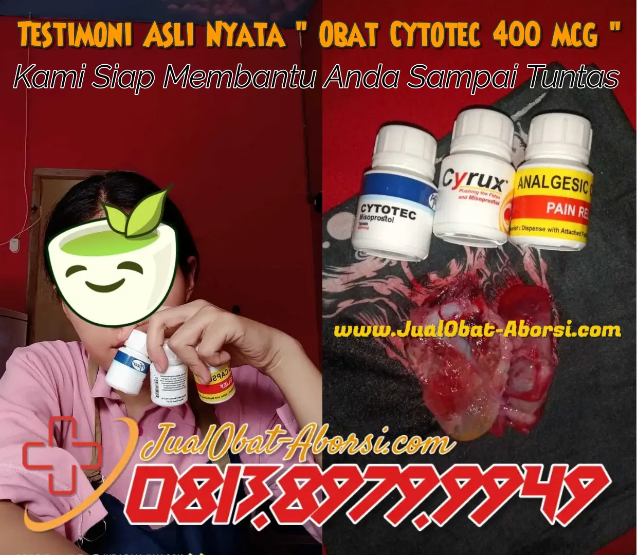 Cara Menggugurkan Kandungan usia 1-5 Bulan dengan Cepat selesai dalam 24 jam secara Alami