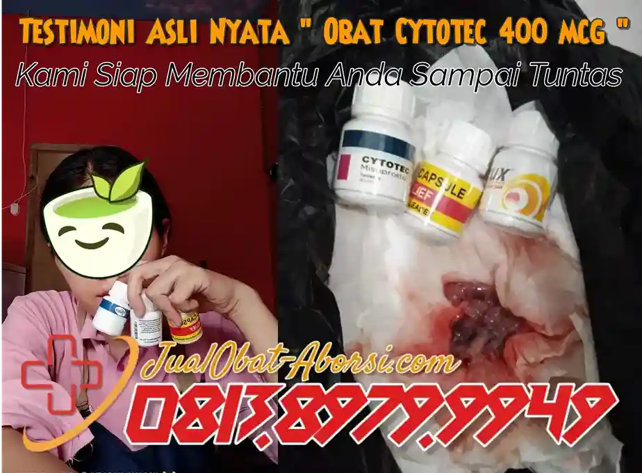 Cara Menggugurkan Kandungan dengan Obat Aborsi yang Aman dan Efektif untuk Kehamilan Tidak Diinginkan